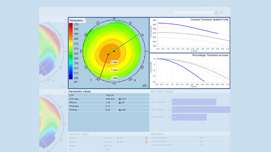 今日の眼疾患治療指針 = Today's Therapy in Ophthal… 眼科専門情報サイトOphthalmology Update【参天製薬】眼科学の